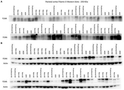 Evidence of Filamin A loss of solubility at the prodromal stage of neuropathologically-defined Alzheimer’s disease